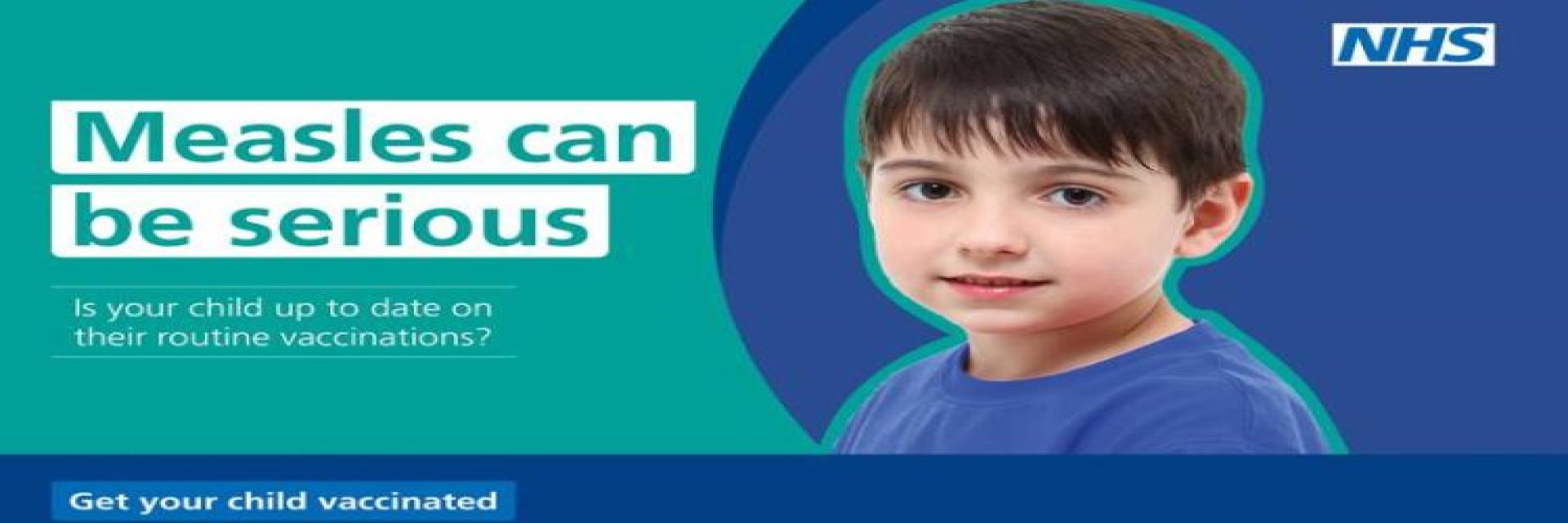 Measles